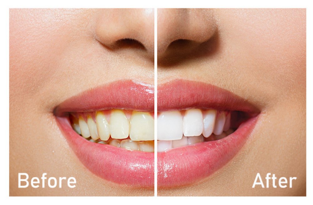 Top China Supplier of Elderly Rehabilitation and Beauty Care Products Top China Supplier of Elderly Rehabilitation and Beauty Care Products