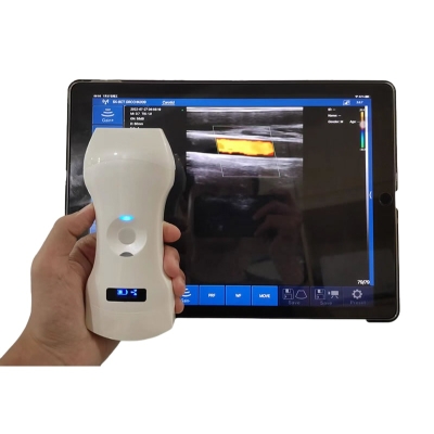 Wireless Color Doppler Ultrasound Palm Portable Scanner Ultrasound Probe