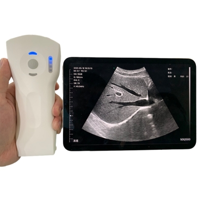 Wireless Doppler Ultrasound Palm B Scanner Ultrasound Probe Mini Sono