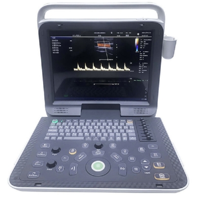 Portable Laptop Color Doppler Ultrasound Diagnostic Medical Digital Doppler