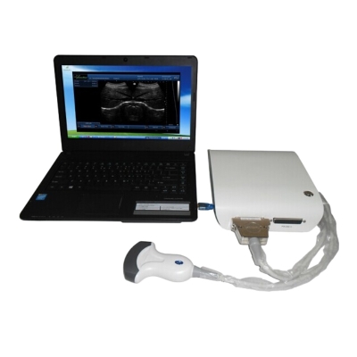 Portable Doppler Ultrasound B Scanner Box with 3D Imaging