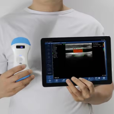 Wireless Color Doppler Ultrasound Machine Palm WIFI Probe Sonda De Ultrasonido