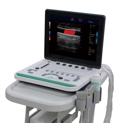 Portable Laptop Color Doppler Ultrasound Medical 3D Doppler