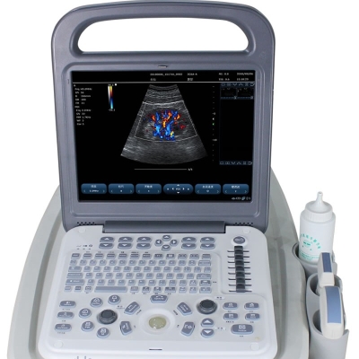 Portable Laptop Color Doppler Ultrasound 2D Medical B Scanner