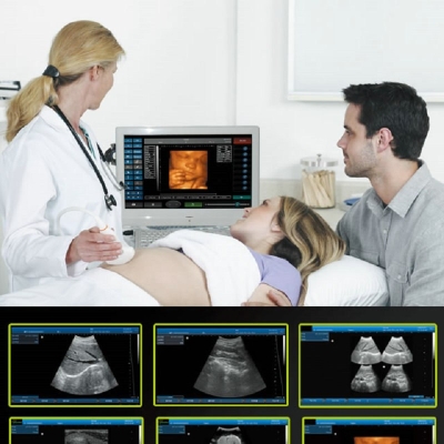 Portable Touch Screen Doppler Ultrasound Diagnostic System Medical Doppler B Scanner