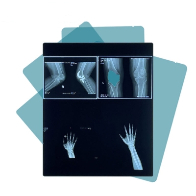 Medical Blue Sensitive X-ray Dry Film Thermal Film with Multiple Sizes