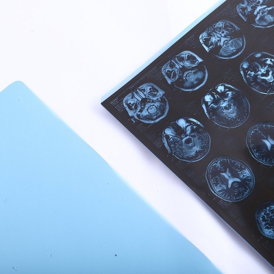 X-ray Imaging Print Film Waterproof Blue Base Dry Inkjet Medical X Ray Film