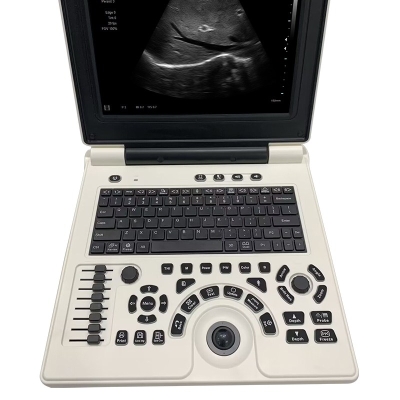 Portable Ultrasound Machine Medical Diagnostic Laptop B Scanner for Veterinary Human