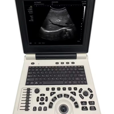 Portable Ultrasound Machine Medical Diagnostic Laptop B Scanner for Veterinary Human