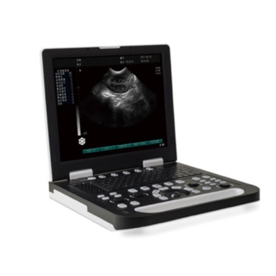 Full Digital Black and White Fetal Doppler Portable Laptop Ultrasound Scanner