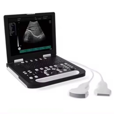 Full Digital Black and White Fetal Doppler Portable Laptop Ultrasound Scanner