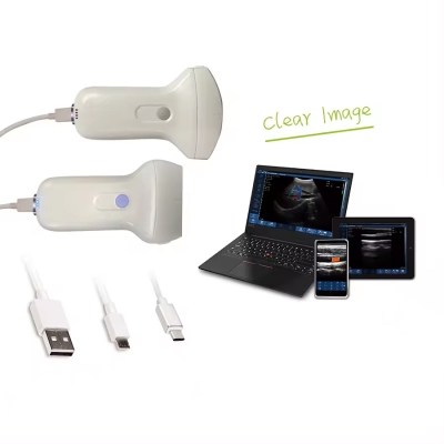 Pocket Probe Medical Diagnostic System Wireless Palm Color Doppler Ultrasound Scanner