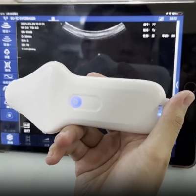 Micro-Convex Palm Doppler Ultrasound Scanner for Ophthalmology Newborn Vet