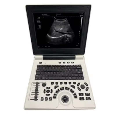 Laptop Color Doppler Medical-Equipment Portable Ultrasound Scanner