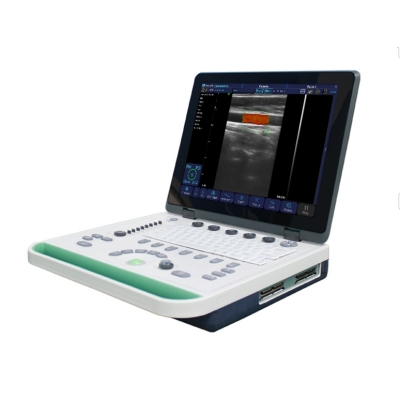 Color Doppler Machine Medical-Diagnosis-Equipment Portable Ultrasound Scanner