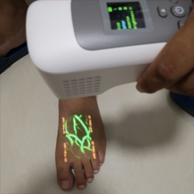 Hospital Injection Venous Scanner Vein Viewer Portable Infrared Vein Finder