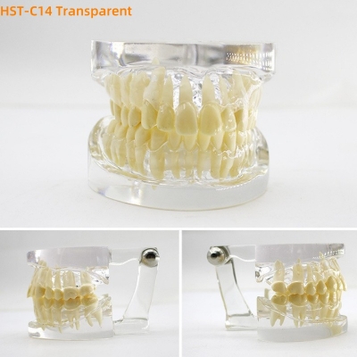 Dental Study Model Comprehensive Pathology Detachable Oral Teaching Model