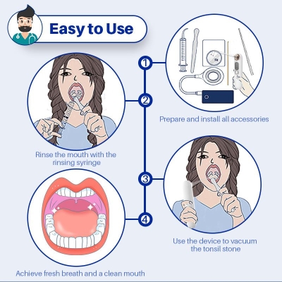 Electric Oral Hygiene Tool Tonsil Stone Remover Oral Flusher