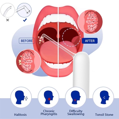 Electric Oral Hygiene Tool Tonsil Stone Remover Oral Flusher