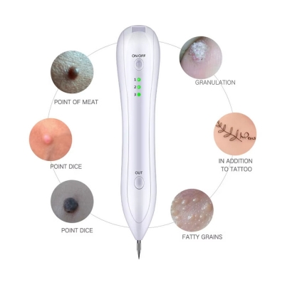 Cheap Price Mole Removal Pen – Skin Tag Remover, Dark Spot Corrector & Eyelid Lifting Beauty Tool for Home Use