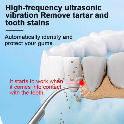 Ultrasonic Teeth Cleaner – Electric Tartar Remover for Daily Oral Care