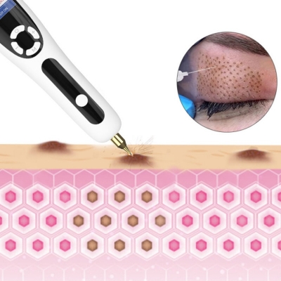 Ozone Fibroblast Plasma Pen for Skin Spot, Mole & Freckle Removal