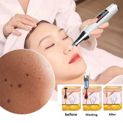 Micro Plasma Beauty Pen for Mole & Skin Tag Removal at Home