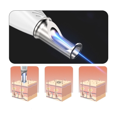 Professional Skin Tag Remover – Painless Spot Remover & Dark Spot Corrector for Home & Salon