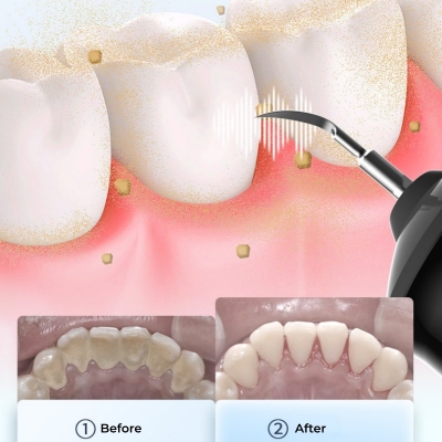 2-in-1 Ultrasonic Teeth Cleaner & Water Flosser – Electric Oral Care Device